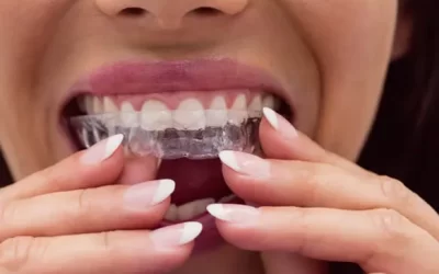 Invisalign Inglewood: Clear Aligner Therapy for Discreet Orthodontic Correction